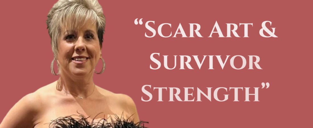 Scar Art & Survivor Strength | Ms. Global Ambassador Kevi Berger on Crowning Connections